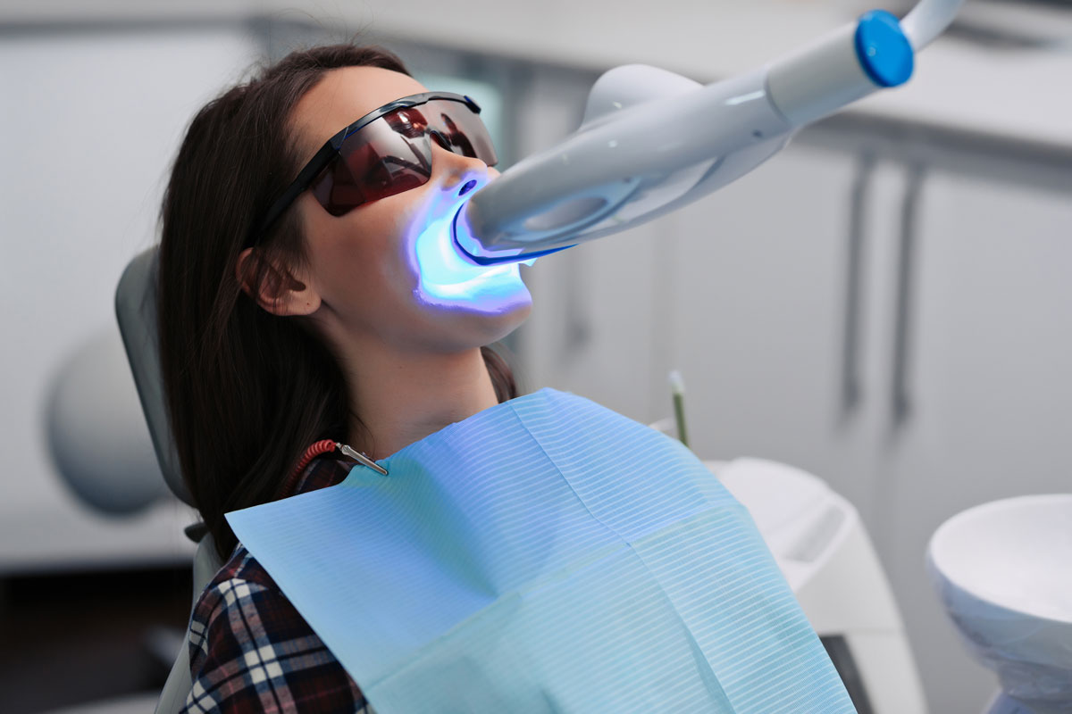 Come ottenere denti più bianchi in 3 modi diversi | Studio Dentistico Schenardi