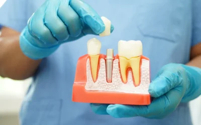 IMPLANTOLOGIA A CARICO IMMEDIATO