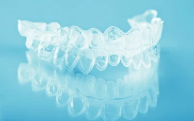 Ortodonzia trasparente: evidenze scientifiche e vantaggi per l’adulto
