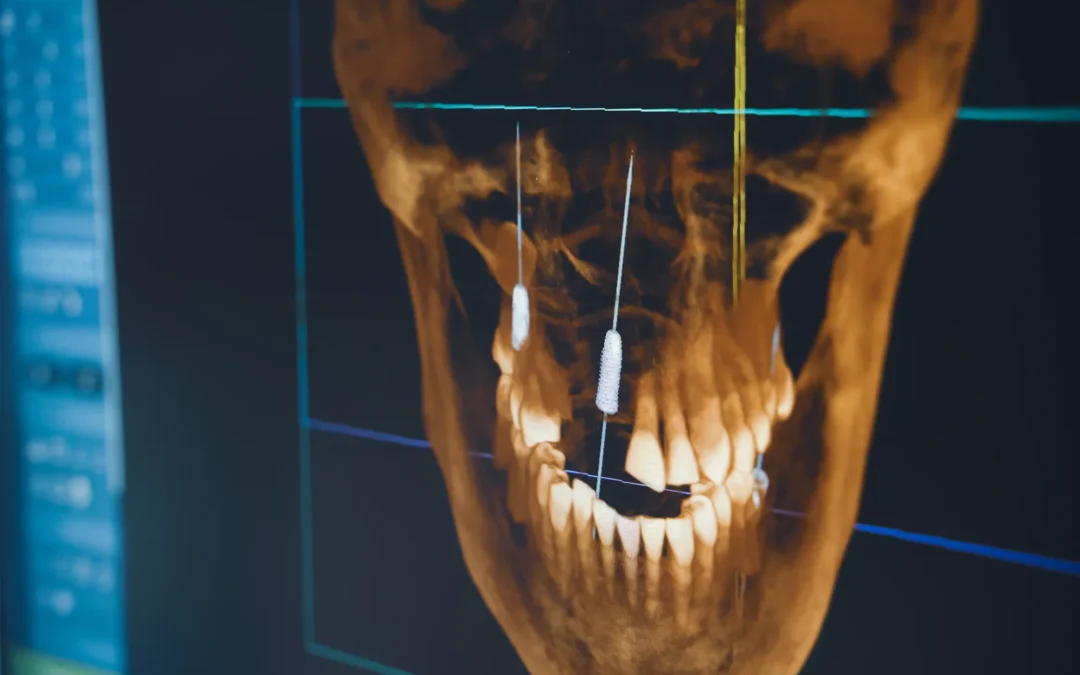 Implantologia a Conegliano: la chirurgia implantare computer guidata allo Studio Schenardi