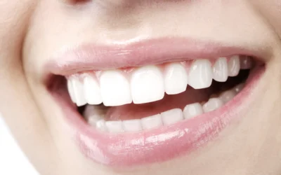 Sbiancamento dentale: il trattamento più veloce non è sempre il più efficace