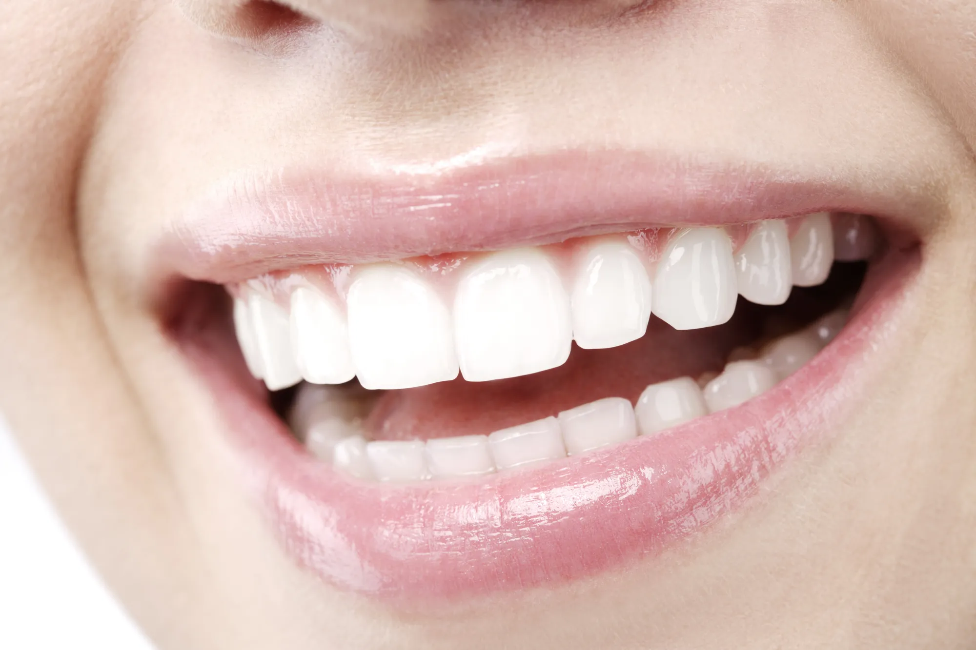 Sbiancamento dentale il trattamento più veloce non è sempre il più efficace
